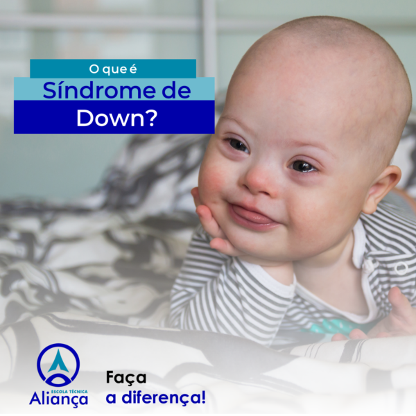 O QUE É A SÍNDROME DE DOWN? - Escola Técnica Aliança